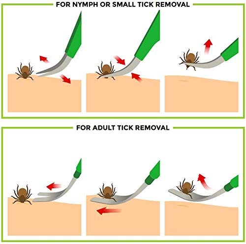 TickCheck Premium Tick Remover Kit - Stainless Steel Tick Remover + Tweezers, Leather Case Free Pocket Tick Identification Card