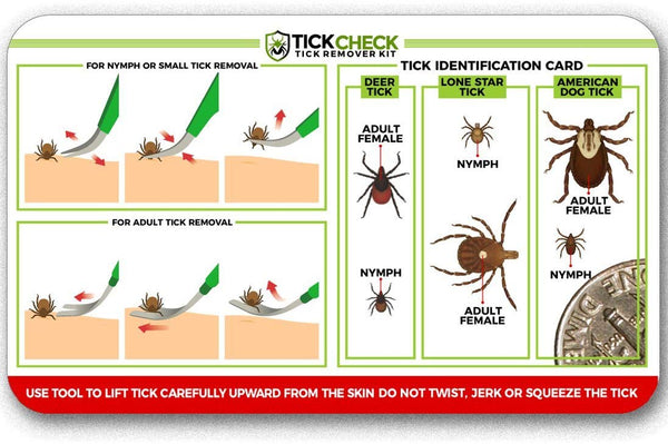 TickCheck Premium Tick Remover Kit - Stainless Steel Tick Remover + Tweezers, Leather Case Free Pocket Tick Identification Card