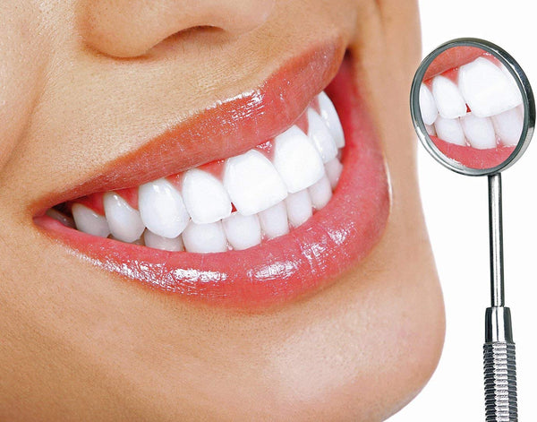 Blanqueadores De Dientes - Kit Blanqueador De Dientes Profesional Con Peroxido De Carbamida Para Aclarar Los Dientes Rapido - Luce Una Sonrisa Mas Blanca